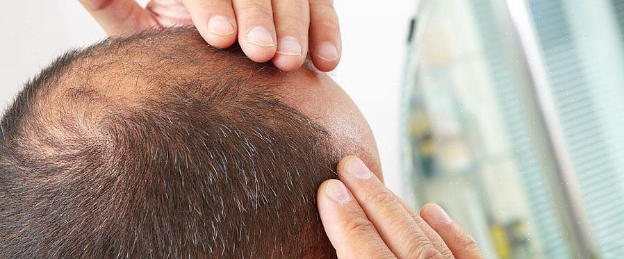יותר גברים מגלחים את הראש ולא מראים שהם מתקרחים או שיש להם שיער דק