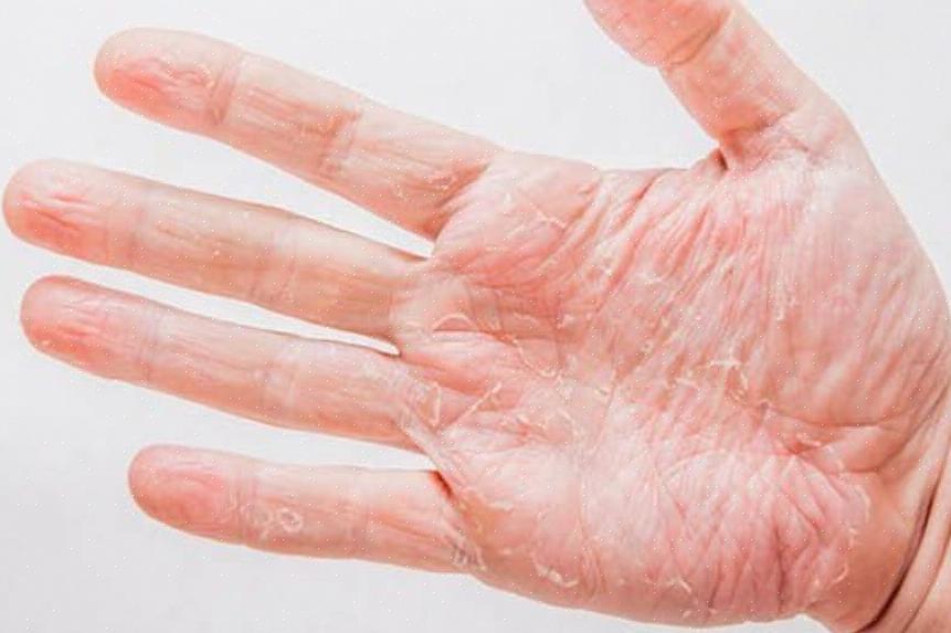 אז אל וודא כי בן לוויה של שטיפת ידיים היומי הוא משהו שיכול לטפל בלחות הידיים שלך יותר